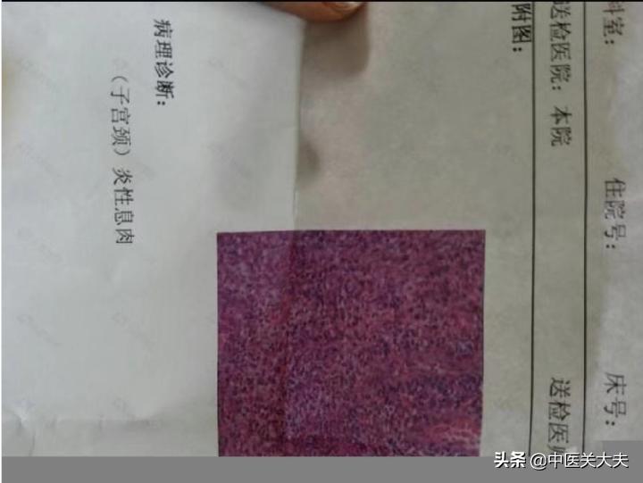 什么体质的身体容易长息肉,胃部长了息肉对身体影响大吗