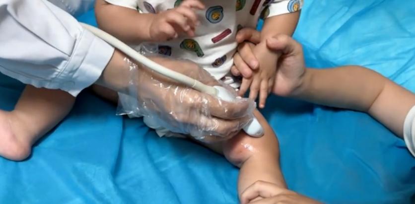 10个月宝宝腿上长了个硬包块,100天宝宝腿上突然长很多疙瘩