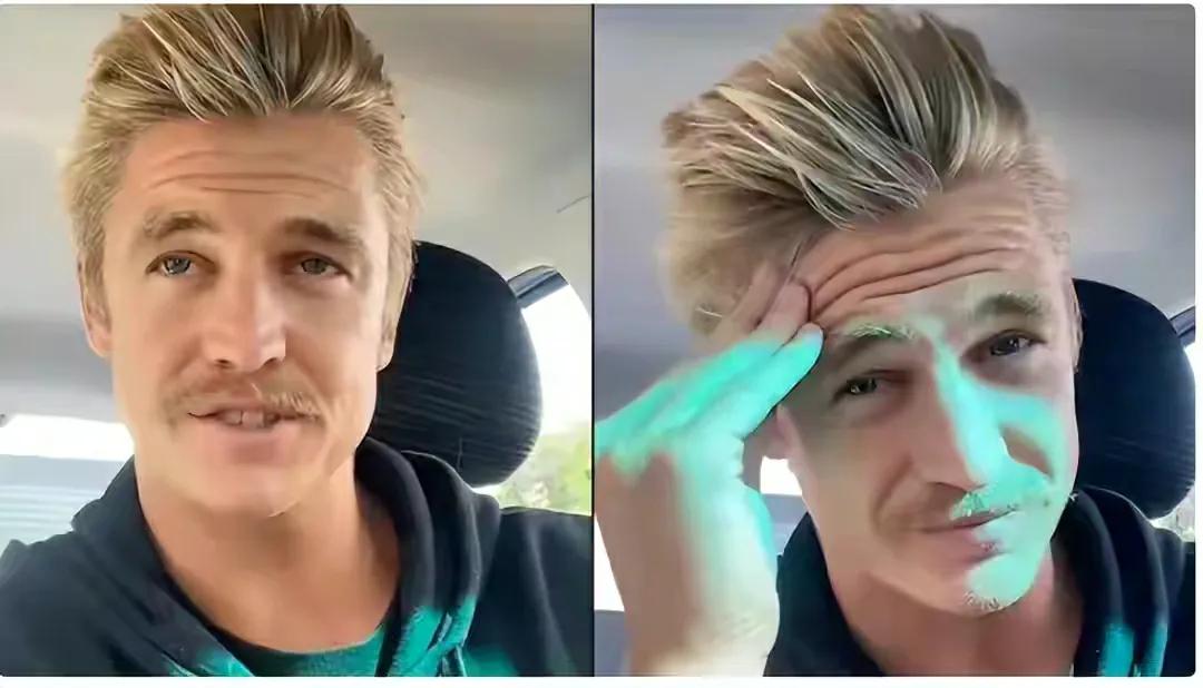 秃头一年不用洗发水头发长出来了,秃头不用洗发水一年后竟长出头发