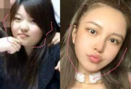 这些整容后都逆袭的女明星,盘点全网那些整容失败的女明星