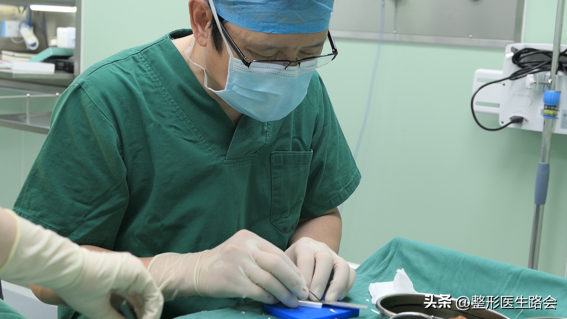 做鼻基底填充消除法令纹有风险吗,鼻基底填充能消除法令纹吗