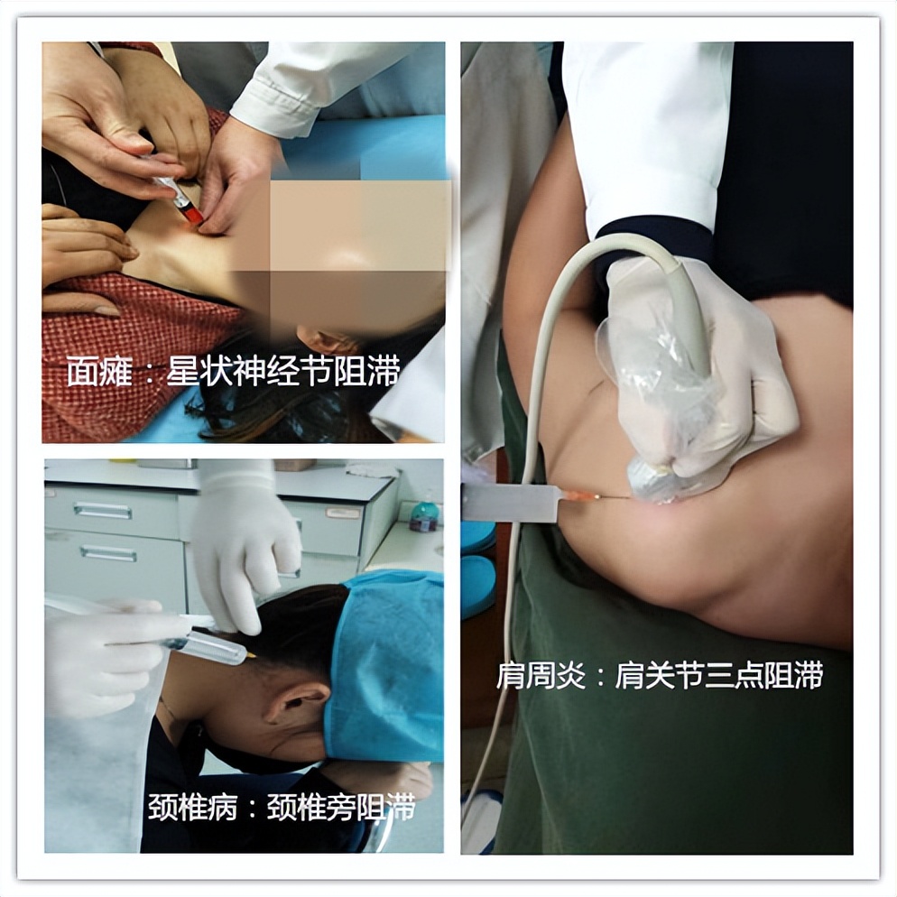 嘉善人民医院疼痛科专家,嘉善第一人民医院中医内科