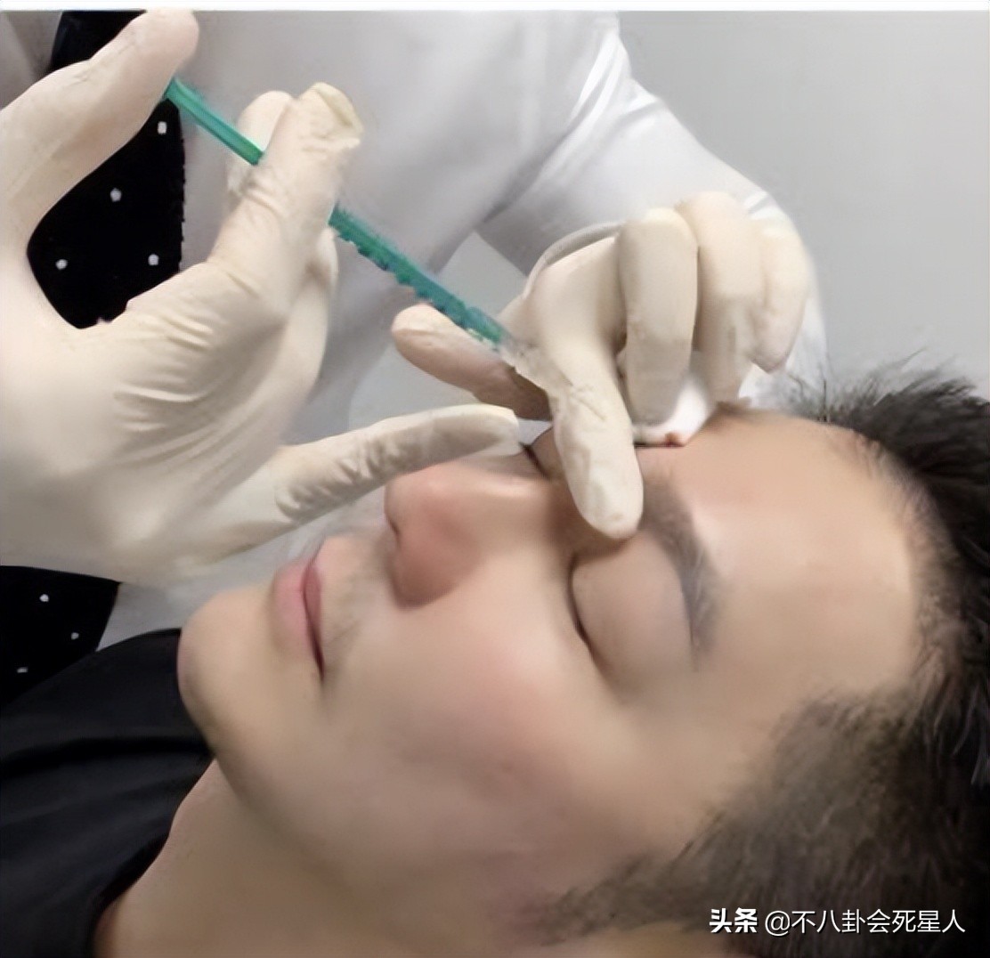 脸部垮掉的男人,脸部塌陷的男生