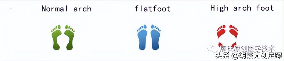 畸形脚穿什么品牌的鞋比较好,畸形脚定制鞋