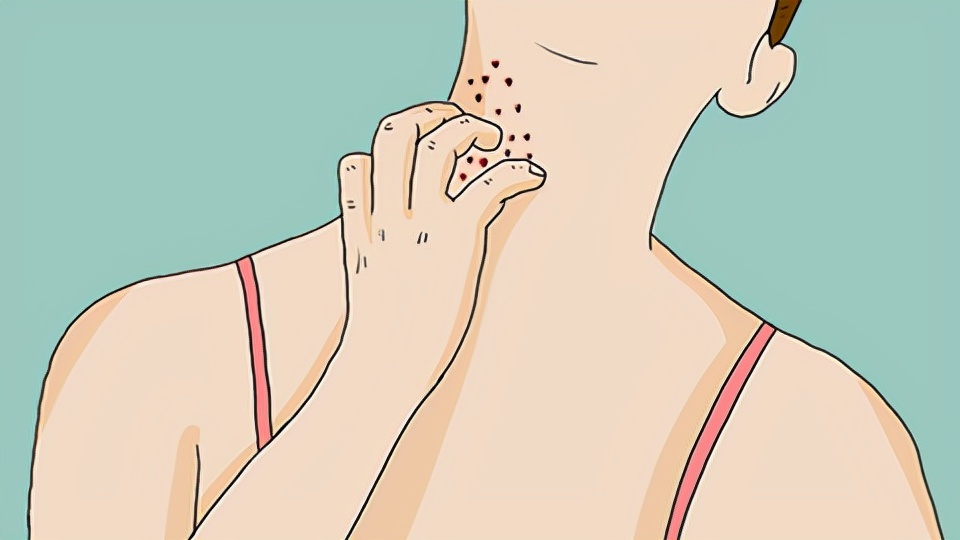 冬天皮肤变得干燥、瘙痒是怎么回事？记住这五点能帮你有效改善