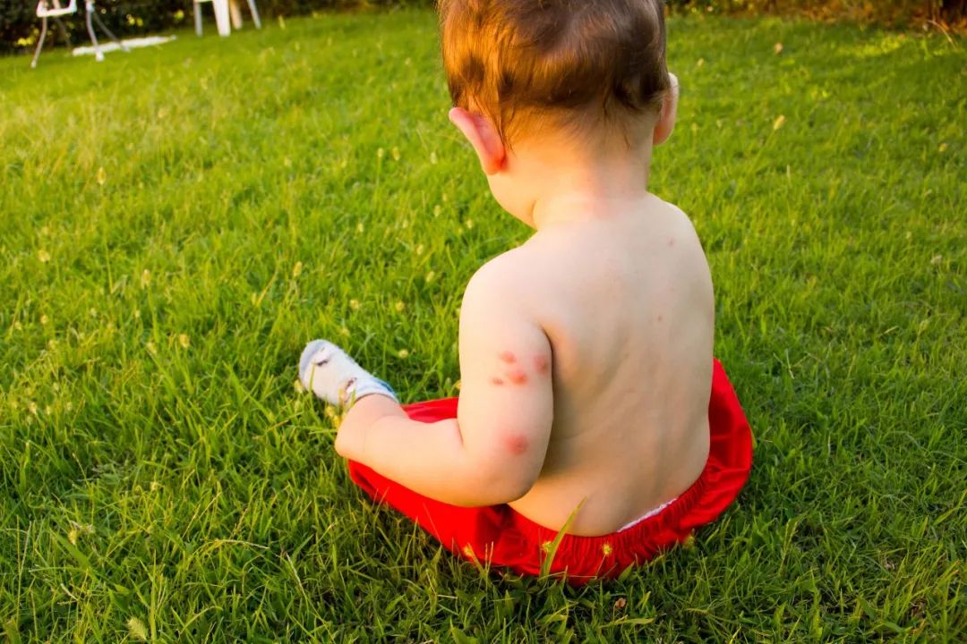 夏季使用蚊香应放在什么地方安全,夏天用电热蚊香液