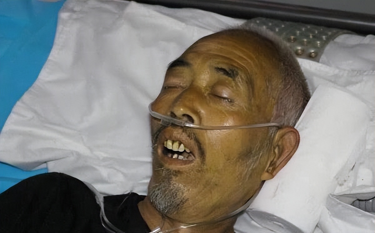 肝癌晚期身上痒是怎么回事,肝癌晚期后背痒是什么原因