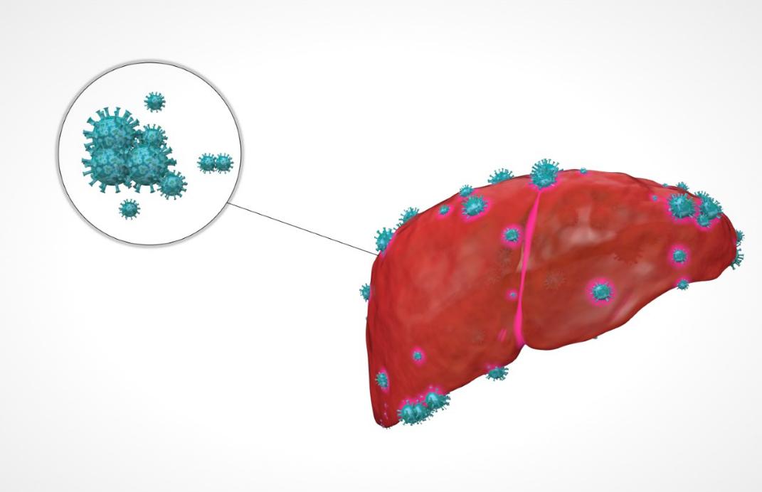 克服癌症复发恐惧的方法,肝癌抗癌最佳方案