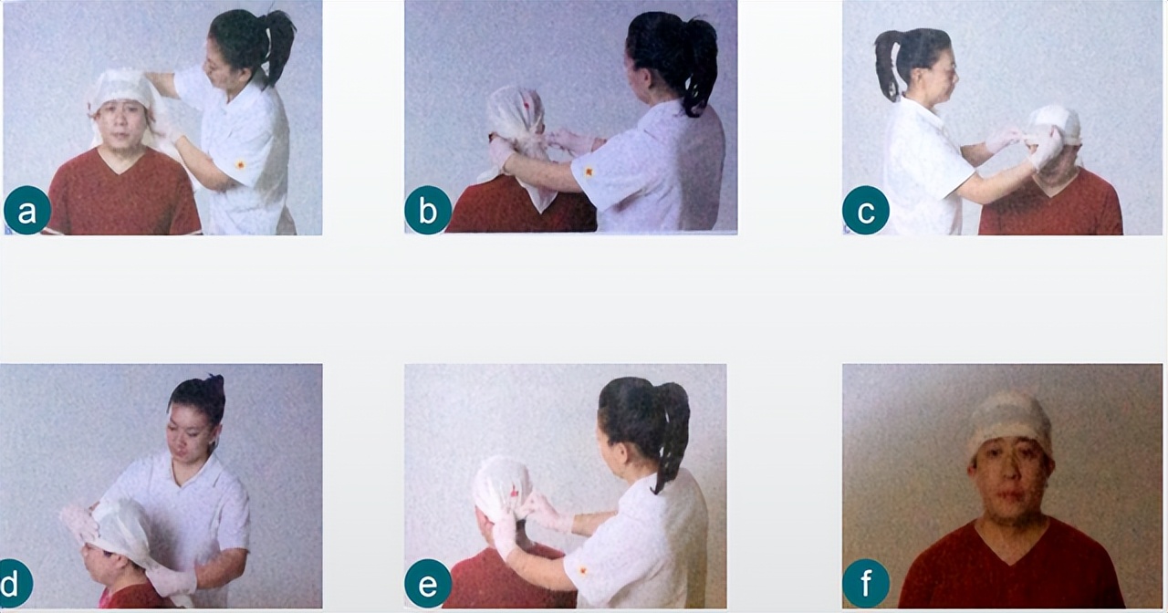 外伤出血的现场包扎技术,外伤出血如何清创包扎