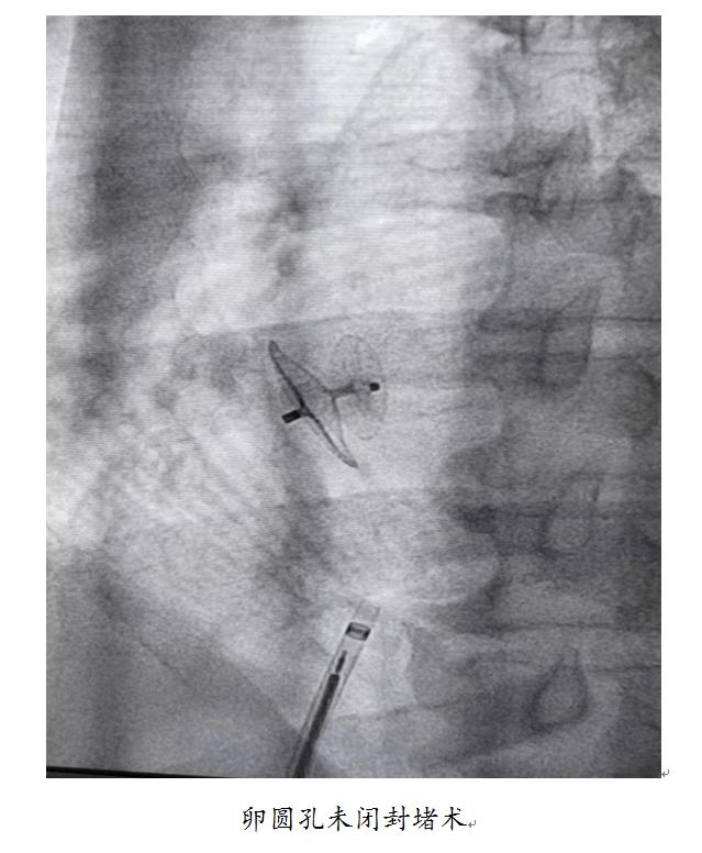 病在脑子根在心脏,病在心