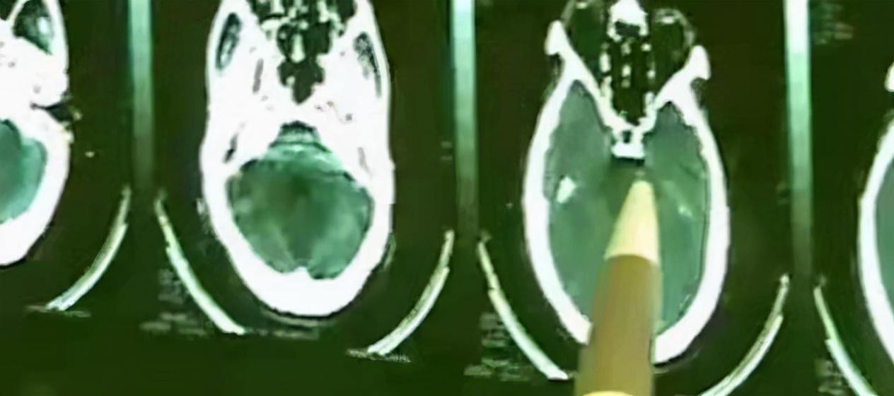 徐州新婚夫妇灭门案,徐州双钉案纪实