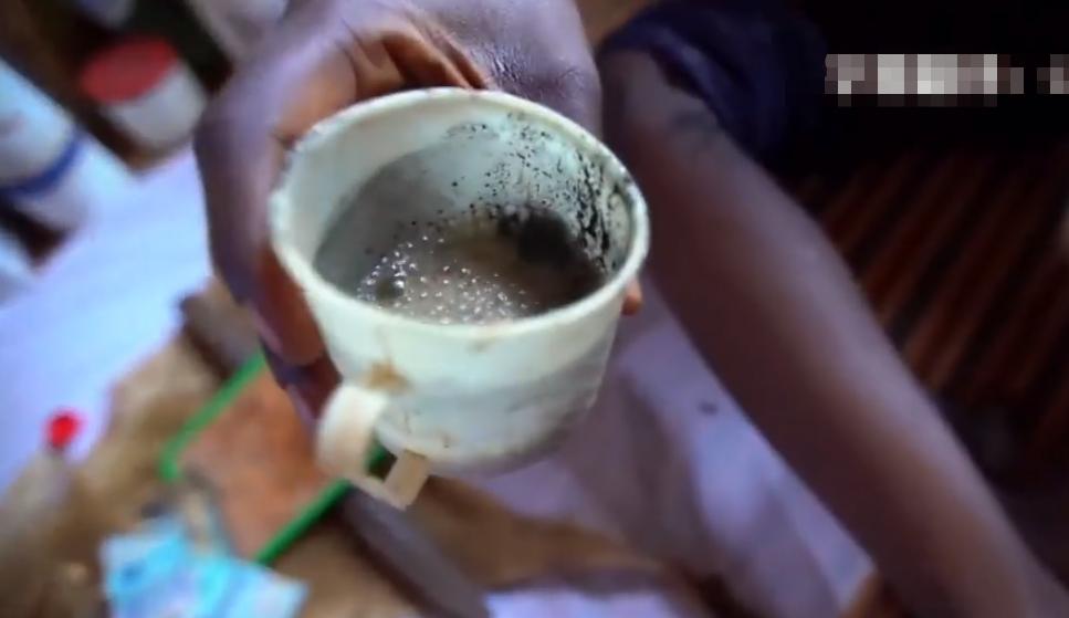 非洲医疗有多恐怖？小伙患上前列腺，医生竟用锤子砸胸口祛除病魔