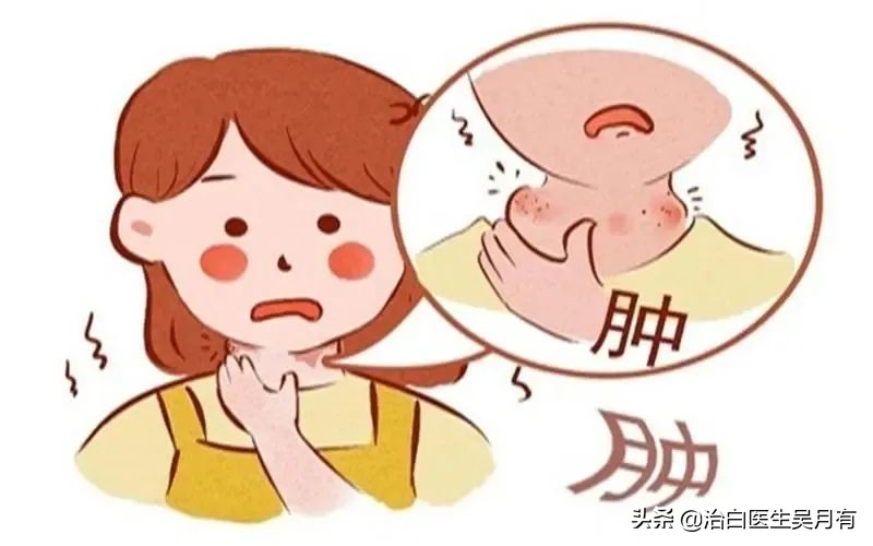 白癜风为什么要检查甲状腺功能,甲状腺引起白癜风是什么情况