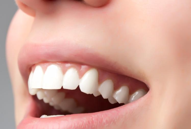 牙龈纤维瘤是肿瘤吗,牙龈纤维瘤会遗传给下一代吗