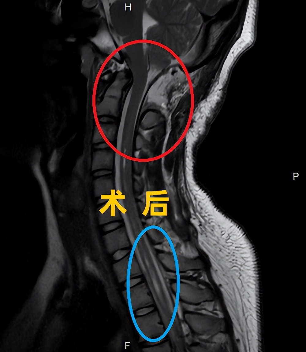 不是颈椎病颈肩痛怎么治疗,不是颈椎病肩膀脖子疼是怎么回事