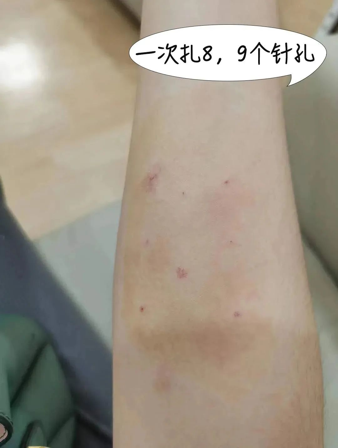 第一胎剖腹产的宝妈,咳嗽咳到剖腹产的刀口那里疼了