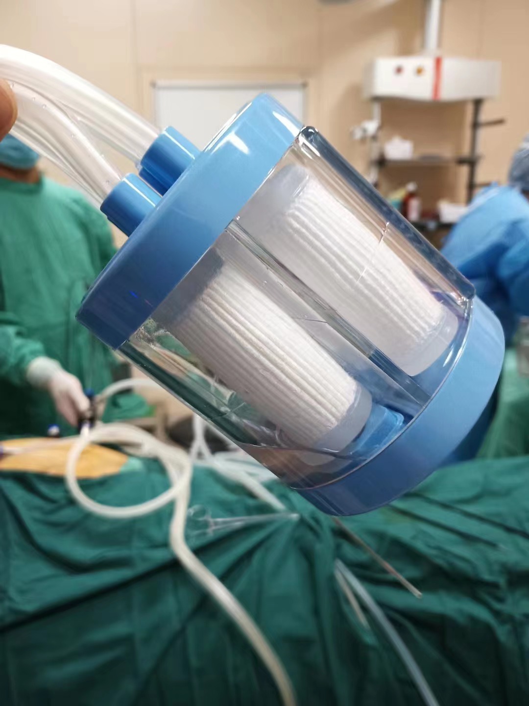 腹腔镜肾切除示意图,腹腔镜肾脏部分切除术