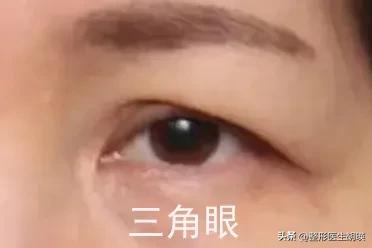 男人常见的眼型测试,常见眼型自测