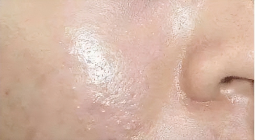 十个绝对有效的控油密招,皮肤控油7步走第4步很重要