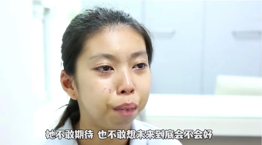 这才是整容存在的意义泰国美女天生没有下巴，整容后迎来全新人生