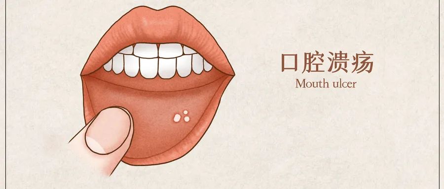 让口腔溃疡快速痊愈的方法,让胃癌患者晚期减少痛苦的方法