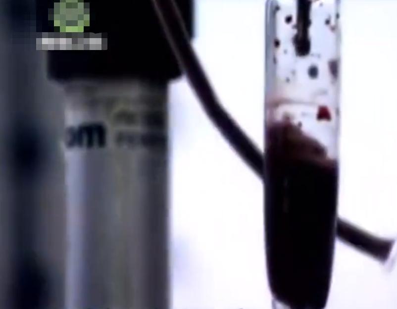 故事：大连39岁姑娘患怪病，皮肤坚硬宛如石膏，专家结论希望渺茫