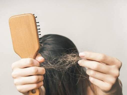 脱发为什么都是从头顶先秃,脱发为什么先从头顶脱