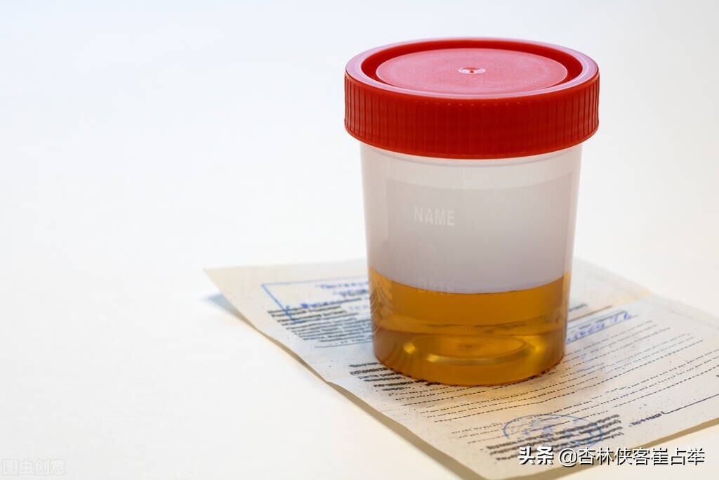 小便感觉上火,如果是上火会引起小便的地方痛吗