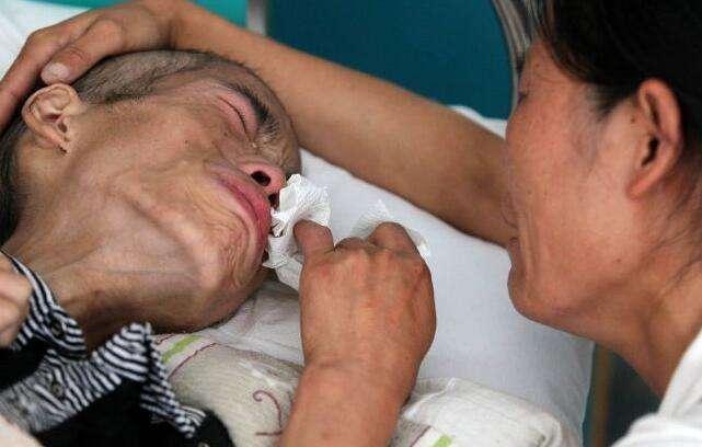 癌细胞转移过程中的症状,淋巴结扩散癌细胞转移可以活多久