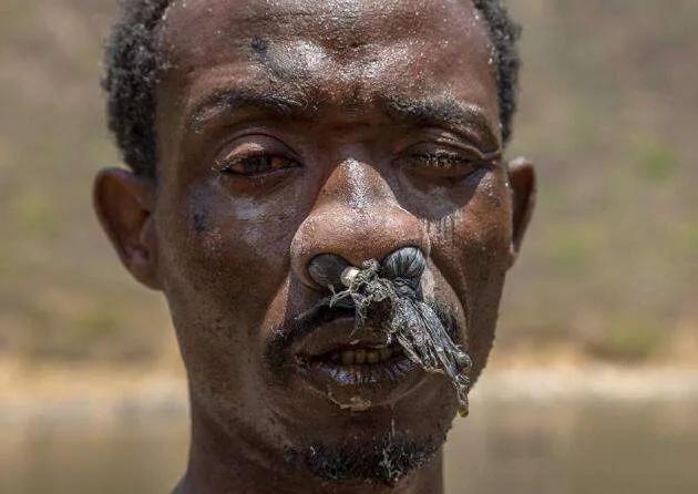 日薪60元的非洲采盐人，用命换钱，几年时间全身溃烂、耳聋失明