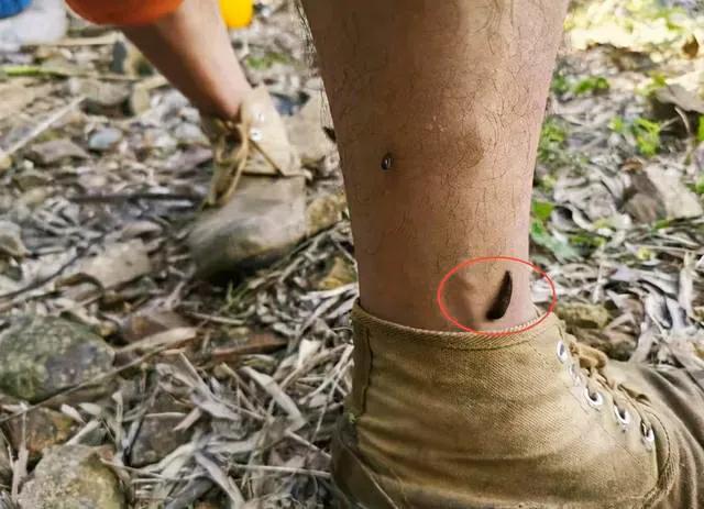 在农村喝井水会怎样,老家的泉水里面有蚂蟥