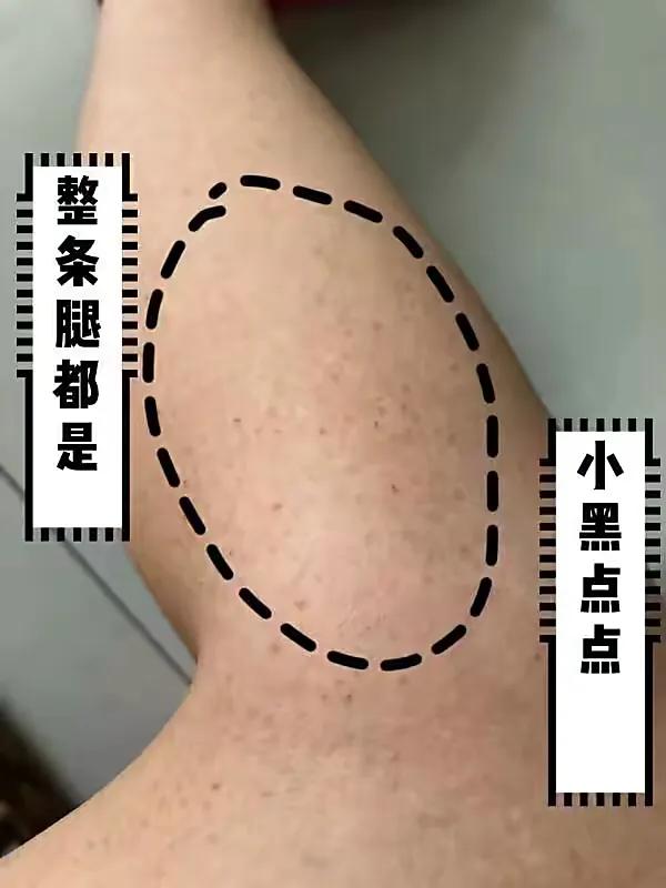 快速养成好皮肤的小窍门,养成皮肤细腻的好方法