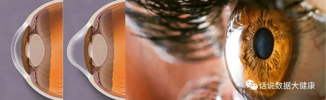 浜哄伐瑙掕啘瑙嗗姏鎭㈠,鐪肩潧澶辨槑鏇存崲浜哄伐瑙掕啘