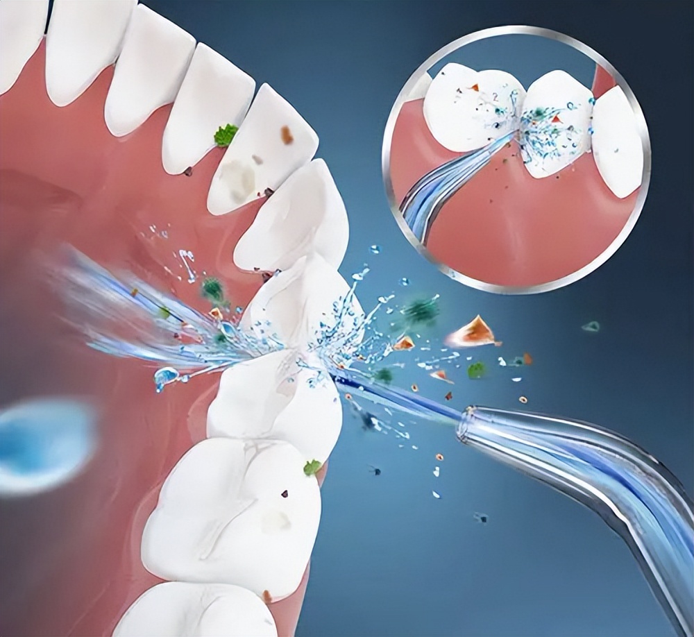 送朋友生日礼物冲牙器好吗,情人节礼物冲牙器
