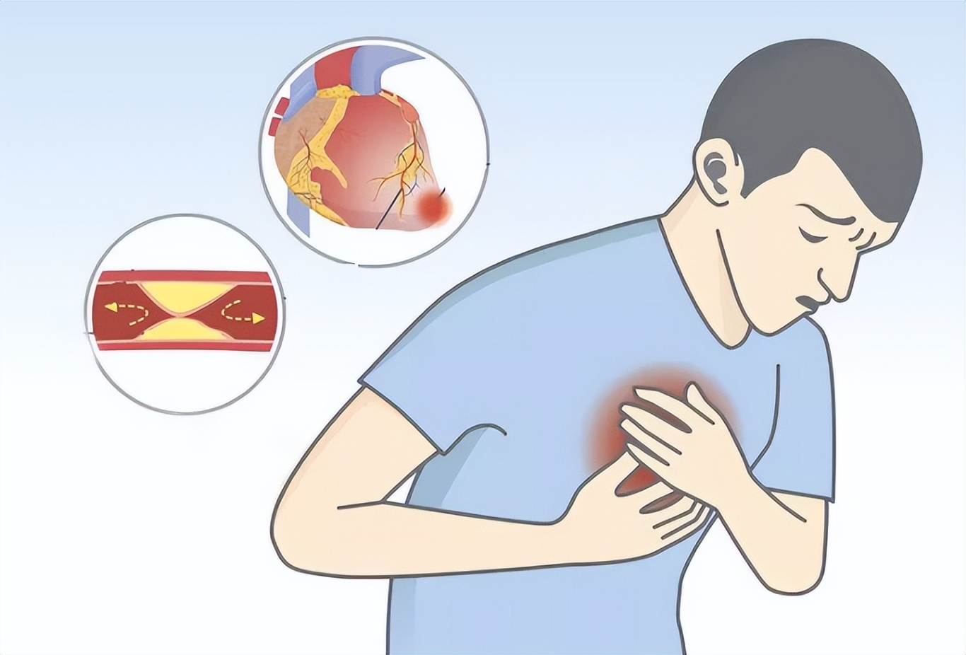 上火了西医怎么治,上火了怎样泻火
