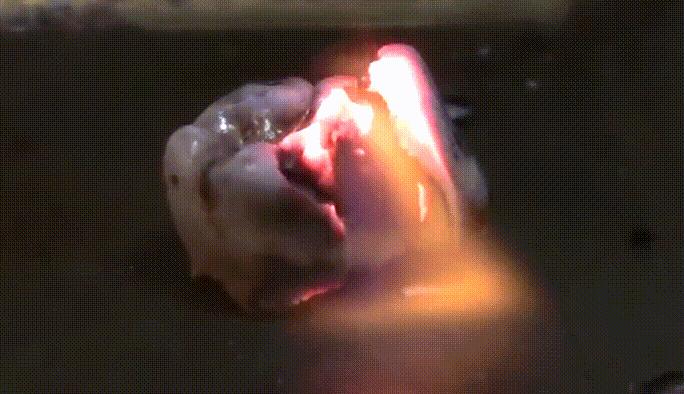 人体最坚硬的部分是牙齿,人体中最坚硬的部位不是头骨吗