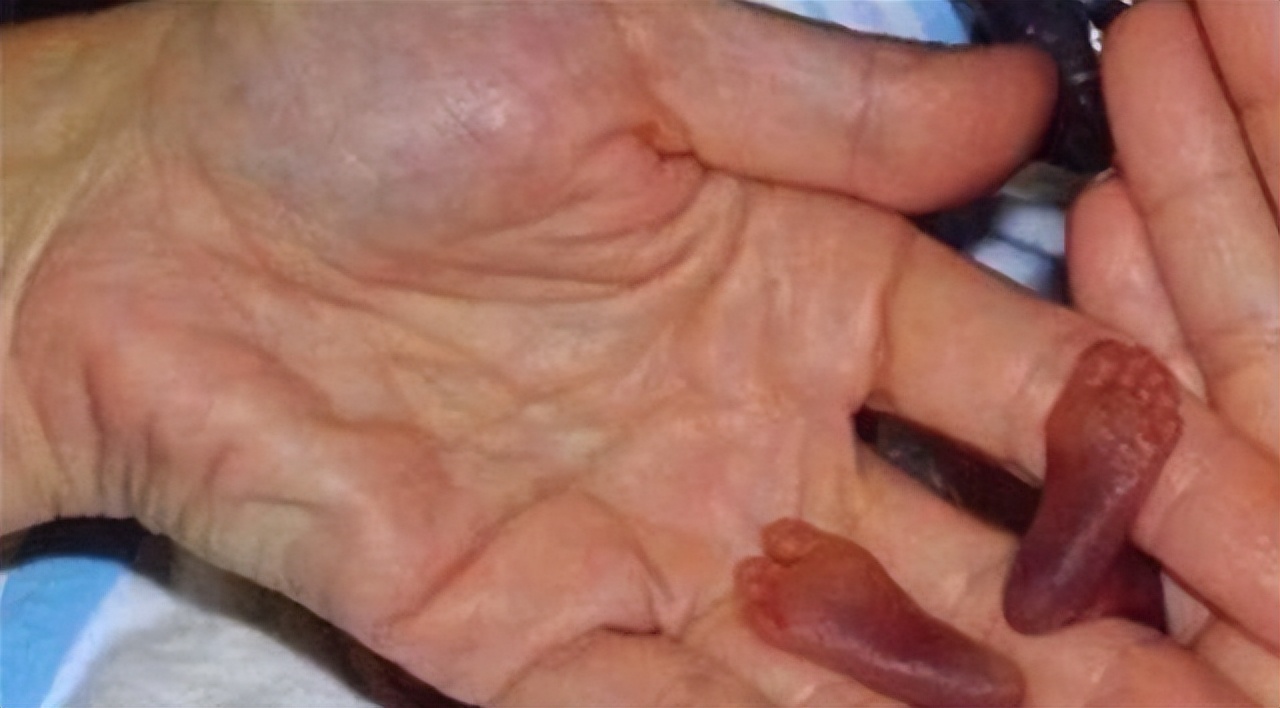 拇指姑娘出生时图片,拇指姑娘刚出生的样子