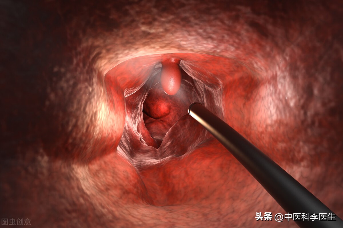 无痛肠镜是挂肛肠科还是消化内科,肠镜无痛和普通哪个预约快