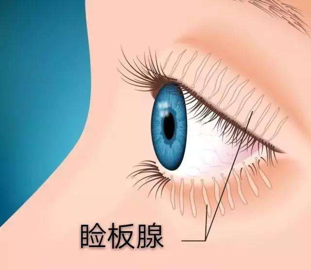 眼皮长了个小疙瘩怎么去掉,右眼皮上长了个小疙瘩预兆