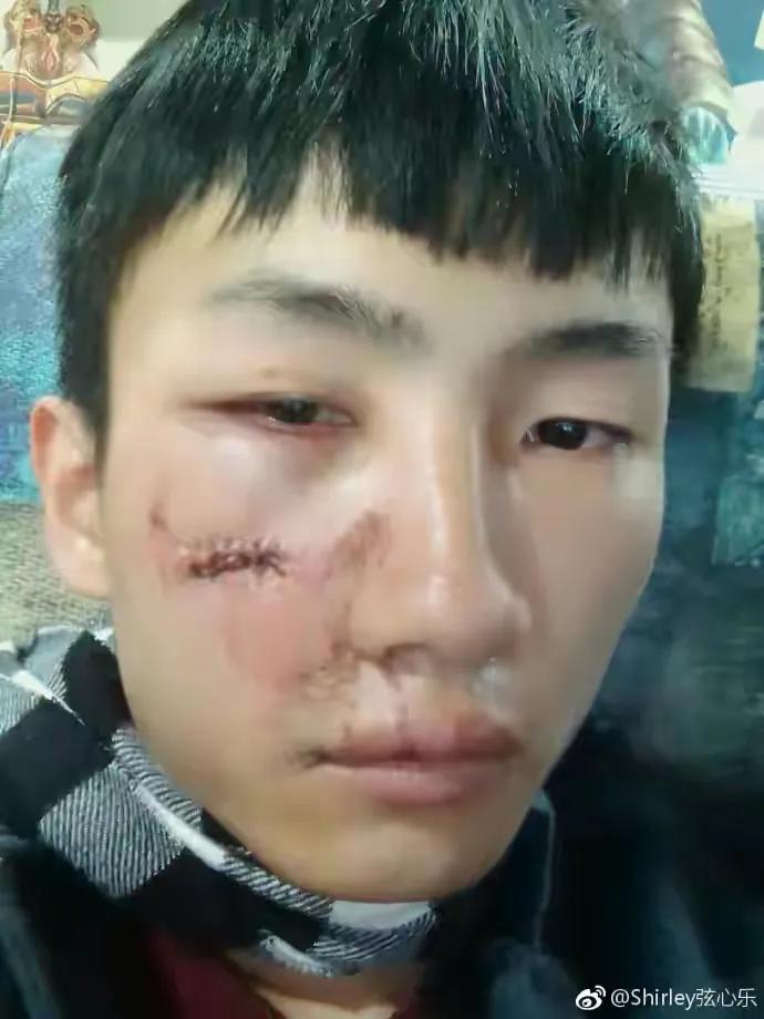 网红宇将军被打,网红宇将军被打前因后果