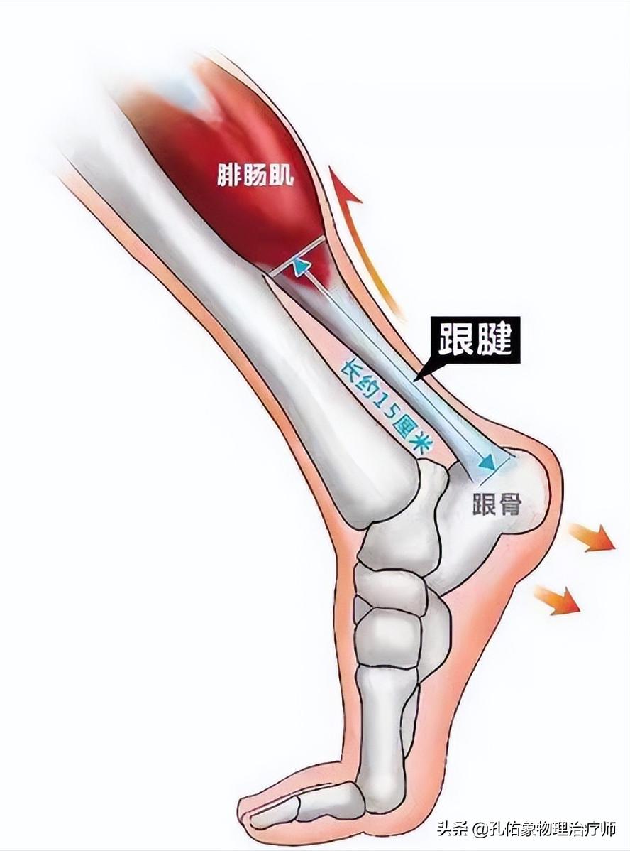 足跟疼痛一走路就疼,走路多足跟痛一招教你解决