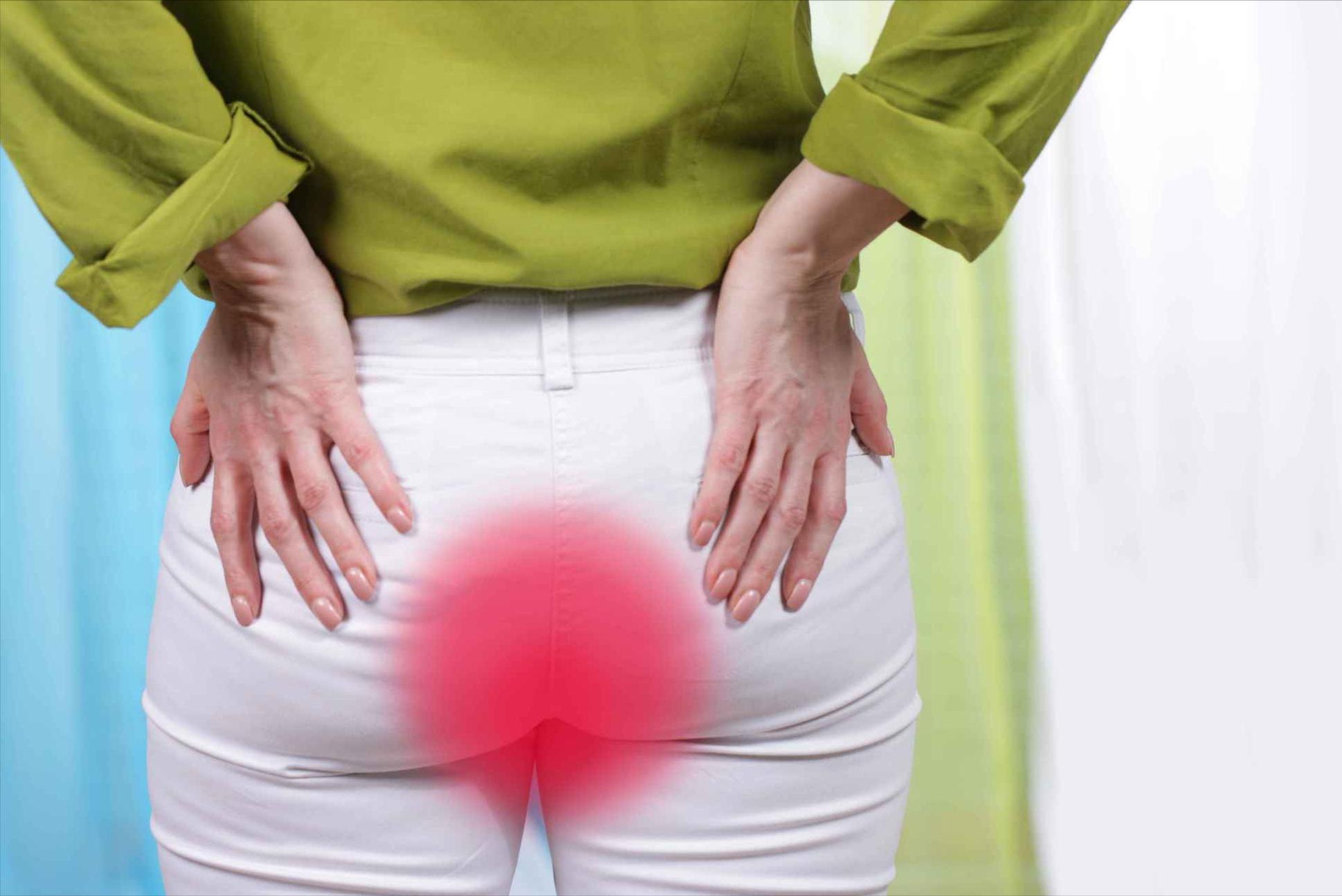 肛门潮湿瘙痒伴有龟裂是什么毛病,中医治疗肛门周围潮湿瘙痒