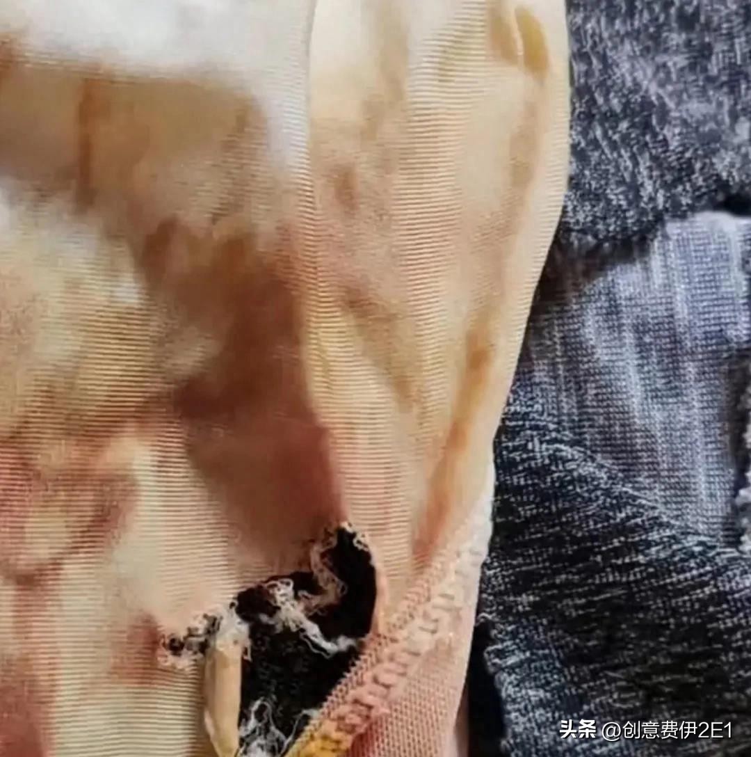 女生夜跑被恶犬咬伤后续,女子夜跑被恶犬咬伤在哪个部位