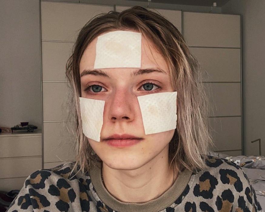 21岁德国模特凭“精灵美貌”火遍亚洲，却突然失踪？牵出黑暗内幕