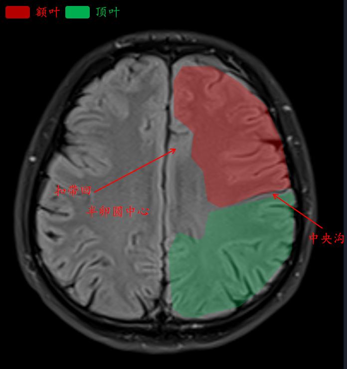 肘关节mri图谱大全,腕关节mri解剖图谱