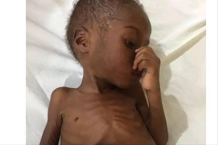 6年前,2岁非洲讨水男孩被好心人收养后,现在过得怎样?