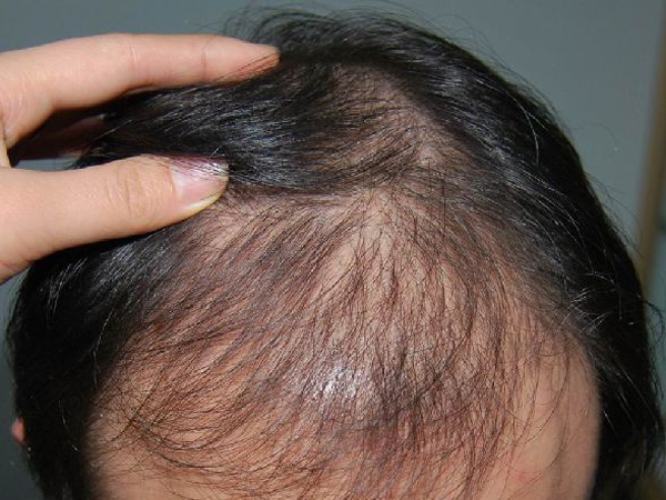 这些生发误区你还在做吗,这些防脱发产品你值得拥有