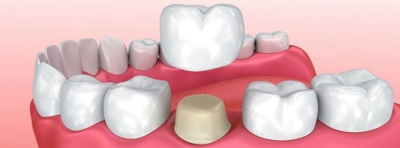门牙缝隙很大影响颜值,门牙缝隙大影响说话清楚吗