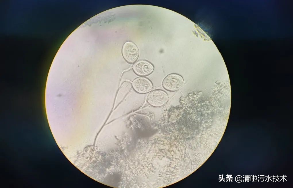 微生物镜检用什么试剂,微生物镜检表