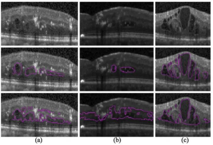 医学影像目标检测框架,开源数据集目标检测